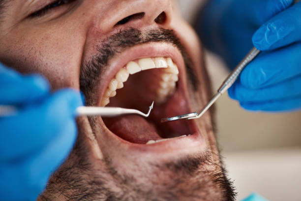 Best Emergency Gum Treatment in Sylvester, GA